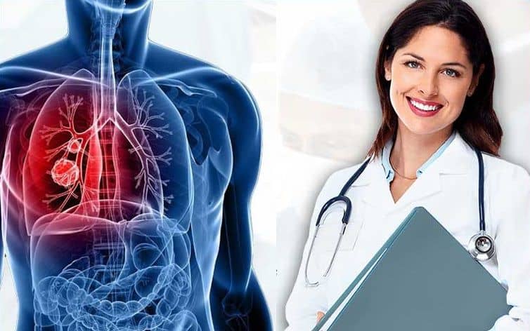  Lung Cancer Treatment in India – Are you aware that it is the leading cause of cancer death in the world?