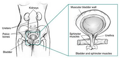 Causes of Urinary Incontinence