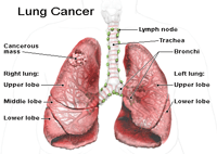 Image Guided Radio-Therapy