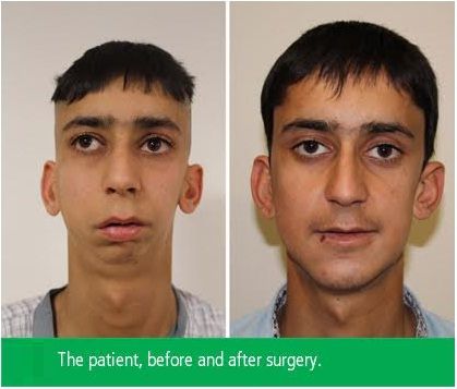 Oral and maxillofacial surgery