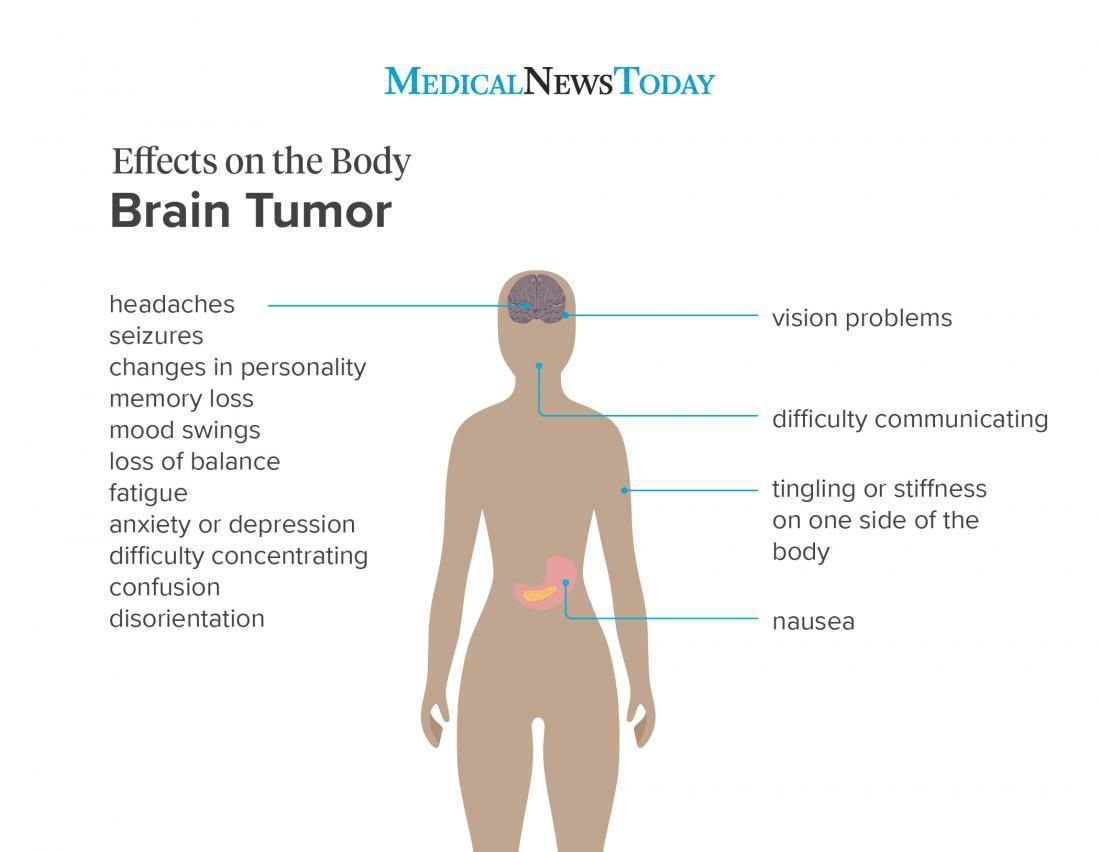 brain tumor surgery 