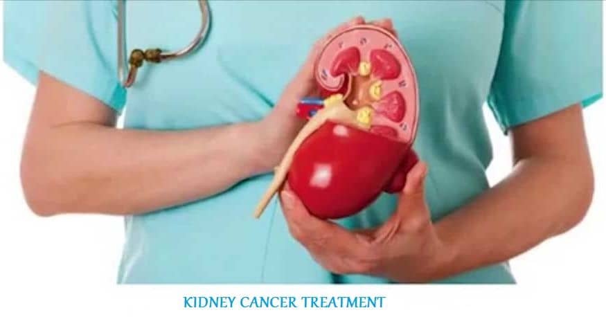  Kidney Cancer – Even though kidney cancer is a slow growing cancer in majority of cases, it behaves aggressively in some patients