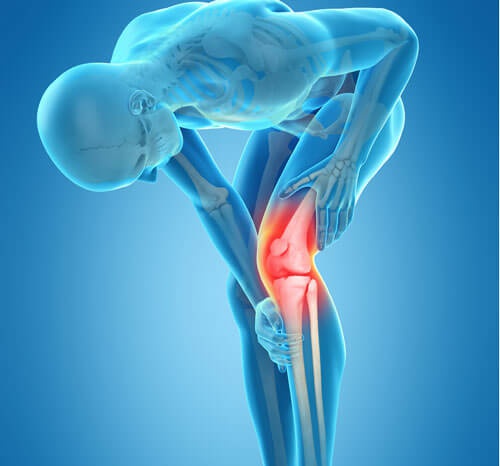 What Is The Cost Of Knee Replacement Surgery In India