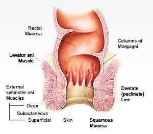 Rectal Cancer Surgery