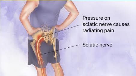 How Much Does A Slipped Disc Surgery Cost In Top Indian Hospitals