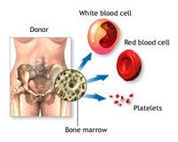Pediatric Bone Marrow Transplant