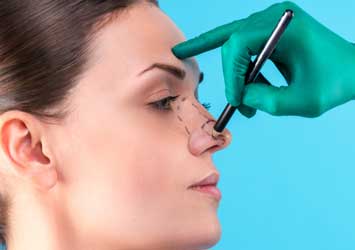 rhinoplasty procedures