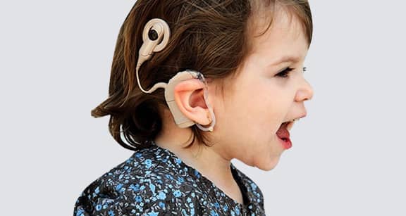 Cochlear Implant Surgery Cost in India