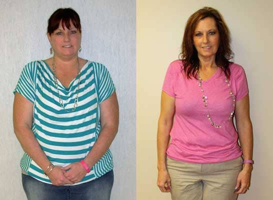 Laparoscopic Gastric Banding Surgery