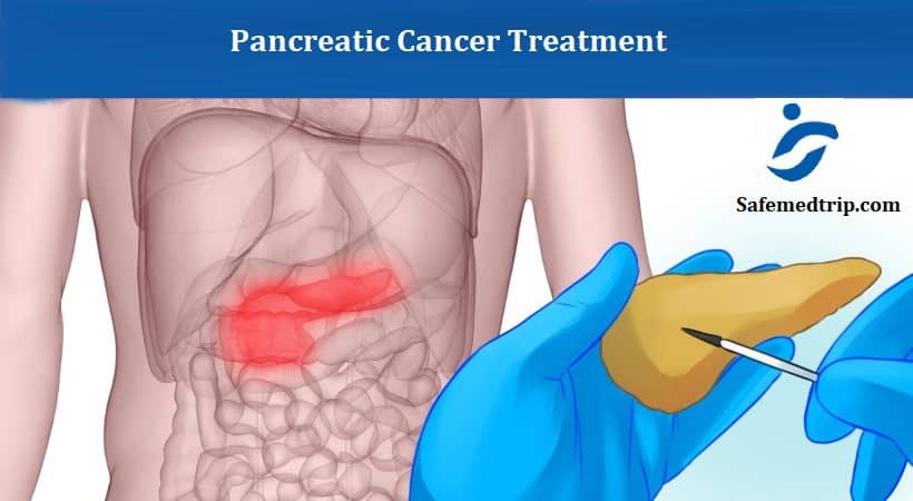 Pancreatic Cancer Treatment Cost in India