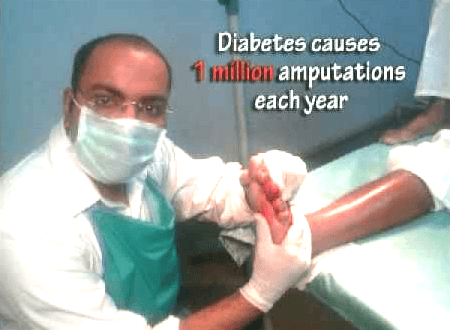 diabetes-causes