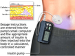 diabetes pump