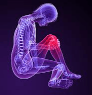 Diagnosis of Meniscus Tear