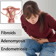 Uterine Artery Embolization