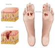 Carotid Endarterectomy Surgery, Aortic Aneurysm Repair Surgery, Aortic Aneurysm Repair Surgery India, Aortic Aneurysm Repair, Aortic Aneurysm Repair Surgery India, Aortic Aneurysm Repair Surgery India, Aortic Aneurysm Repair Surgery Price, Aneurysm Repair