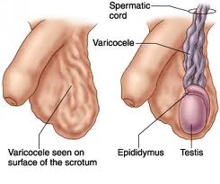 Diagnosis