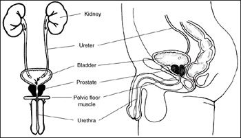 Male Incontinence