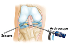 Surgical Treatment