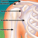 Fractured Head of The Humerus