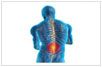 Best treatment for spine disorders from correction of birth defects, Treatment of spine degeneration