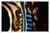 Cervical Disc Replacement by Best surgeons in India