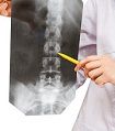 Spine treatment analysis by expets doctors