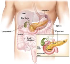 Types of Pancreatic Cancer