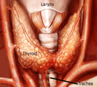 disorders of Thyroid