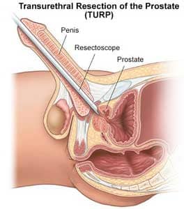 Surgical Procedures