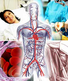 Vascular Surgery