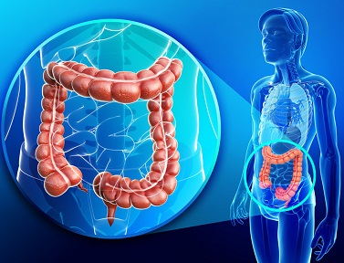  Facts About Colorectal Cancer -Colon & Colorectal Cancer