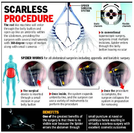  SafeMedTrip affiliated World class hospital in India introduces Scar-less Laparoscopic Surgery