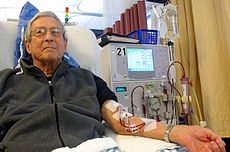  Why it’s a Better to go for Kidney replacement Surgery than Dialysis ?