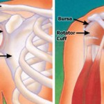  Different Types of Shoulder Surgery Procedures in India