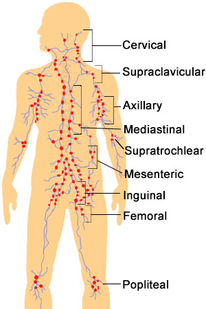  Diagnosis and Treatment of  Lymphoma Cancer at World Class Hospitals in India