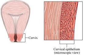  All you need to know about Cervical Cancer- Cervical Cancer Treatment at World Class Hospitals in India