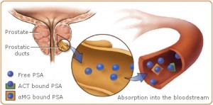  Testing & Treatment for Prostate Cancer : Prostate Cancer Treatment in India