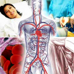  Vascular Surgery at World Class Hospitals in India