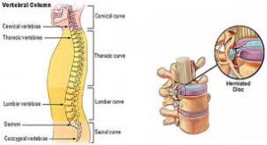  Non fusion spine surgery, for the lumbar and cervical spine or Artificial disc replacement surgery is a great advantage for chronic spine patients