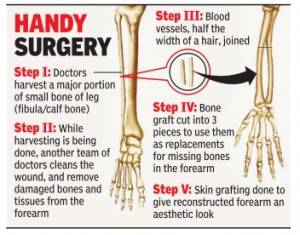  Nigerian patient hand reconstructed successfully after 8-hour long surgery at SafeMedTrip affiliated  World Class Hospital in India