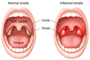 tonsils