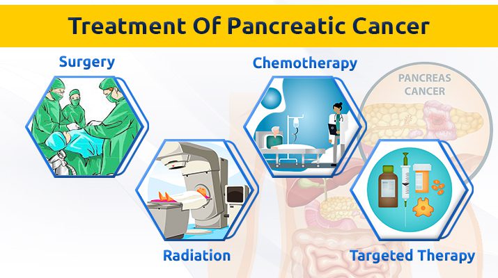 Treatment Of Pancreatic Cancer